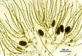 Corynophlaea hamelii3